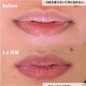 恵比寿で人気のリップアートメイク｜血色の良い理想の唇ならArt